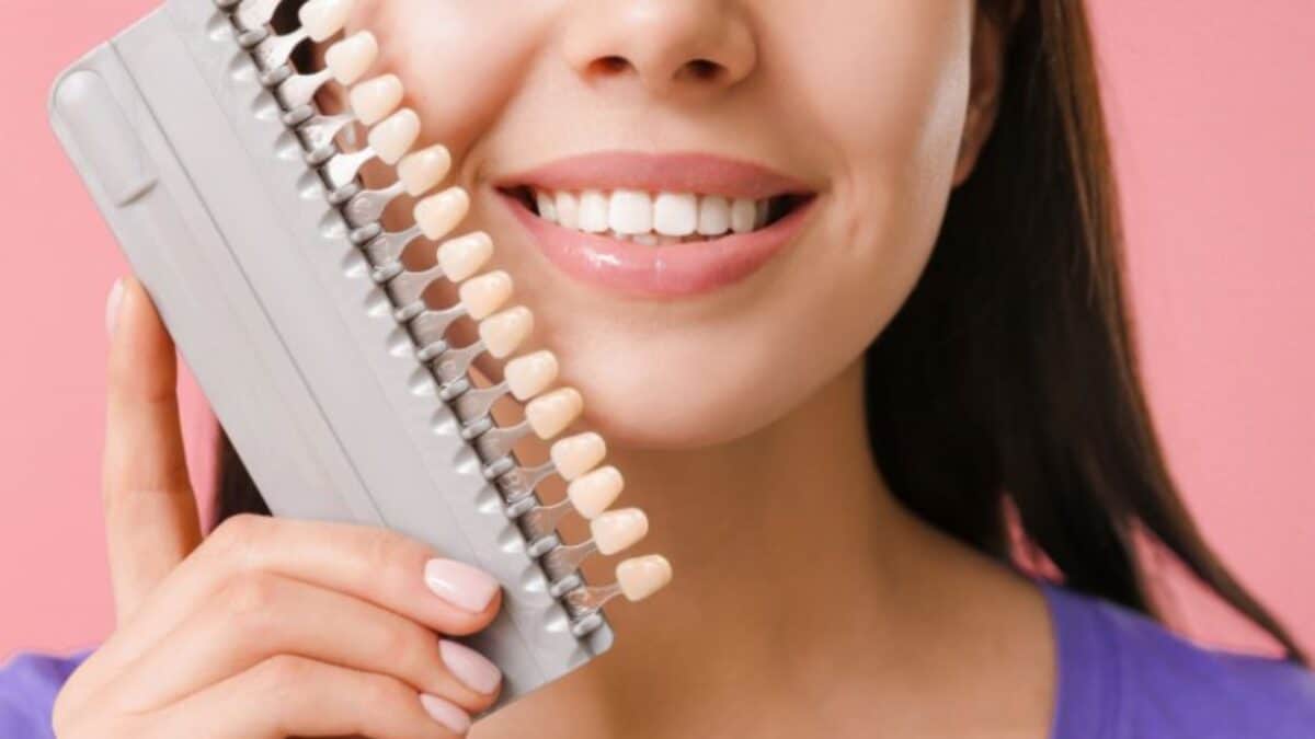 Benefits of Choosing Dental Veneers for a Perfect Smile