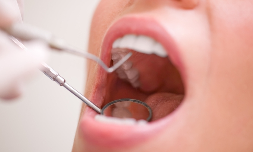 Essential Dental Cleanings at Pinole Aesthetic Dentistry