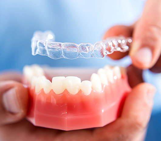 Invisalign in Charlotte, NC - Regal Oaks Dental
