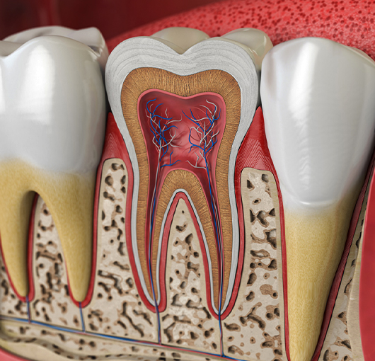Root Canal Treatment in Charlotte, NC - Regal Oaks Dental