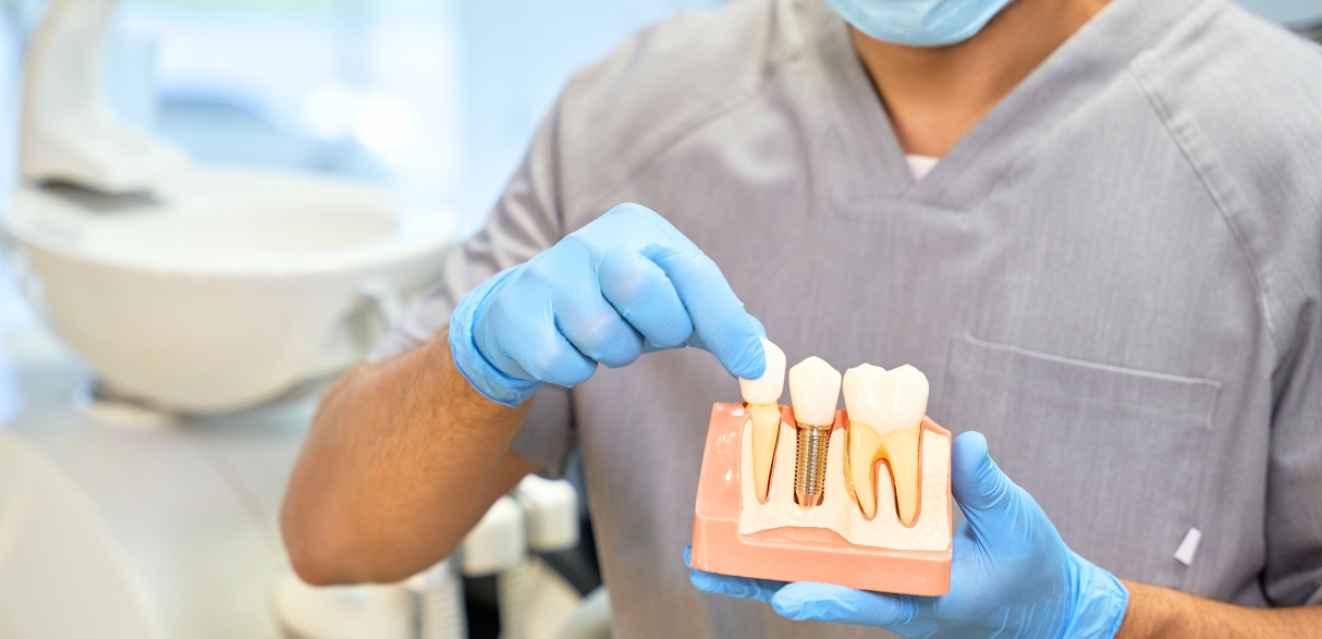 pain expectation from dental implant