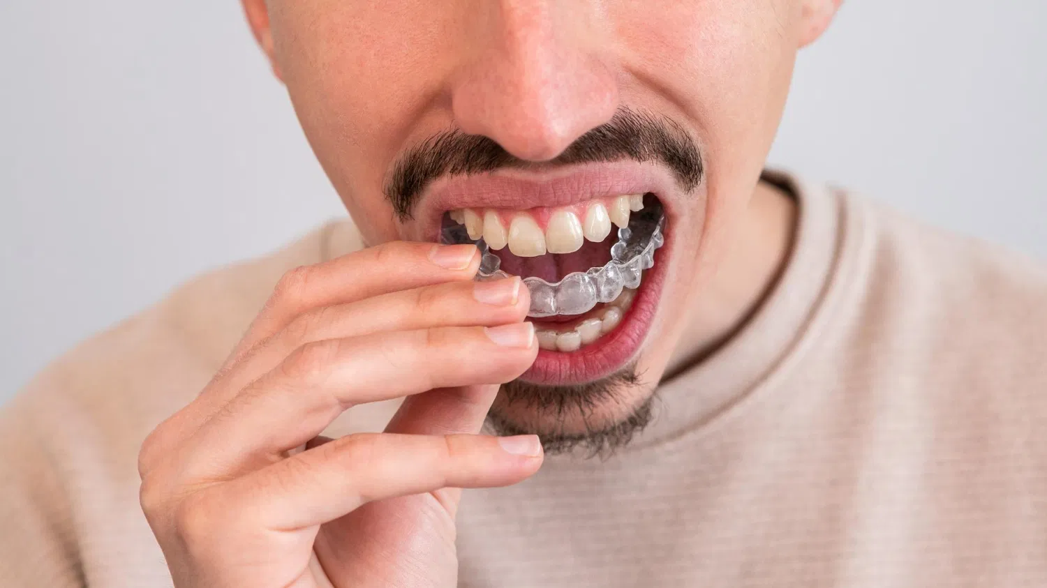 Featured image for “How Oral Appliance Therapy Can Relieve TMJ”