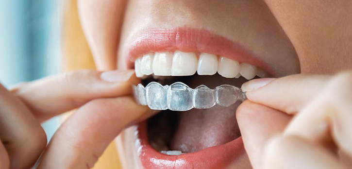 Orthodontics in San Jose, CA